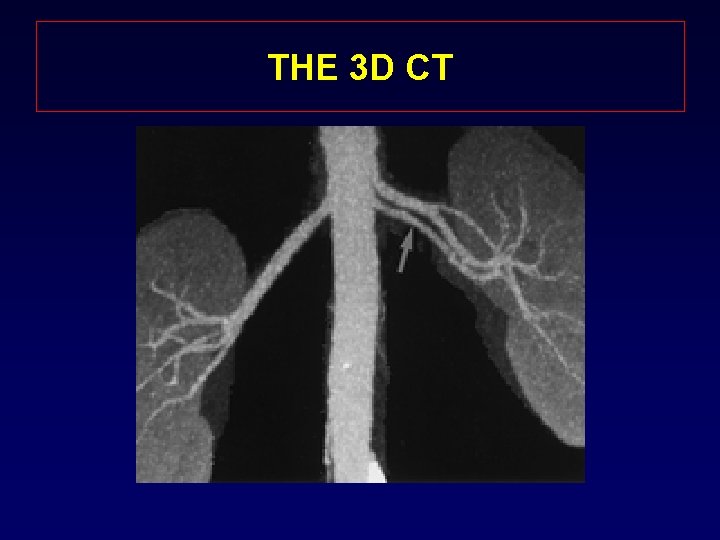 THE 3 D CT 