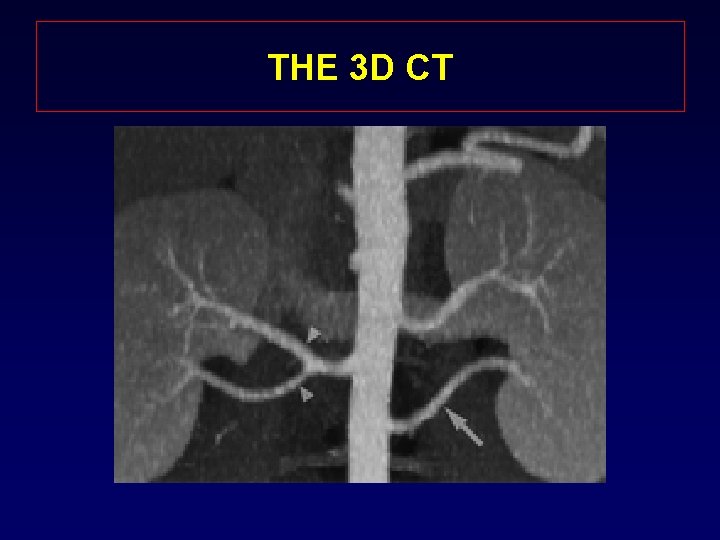 THE 3 D CT 