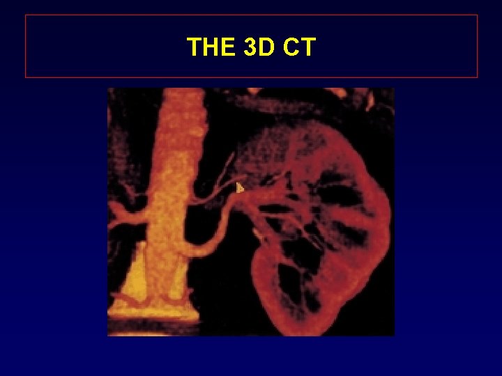 THE 3 D CT 