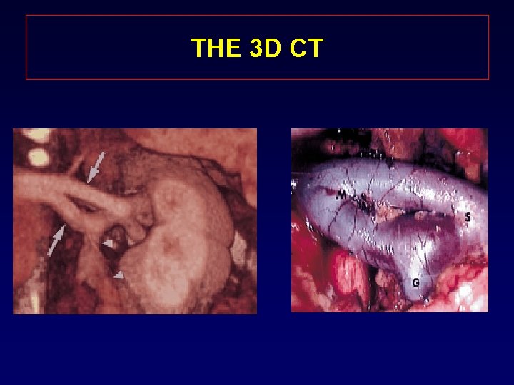 THE 3 D CT 