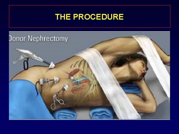 THE PROCEDURE 