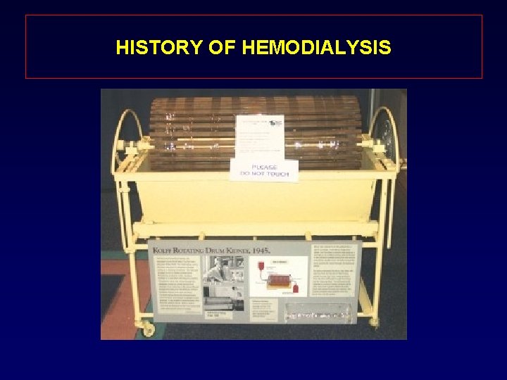 HISTORY OF HEMODIALYSIS 