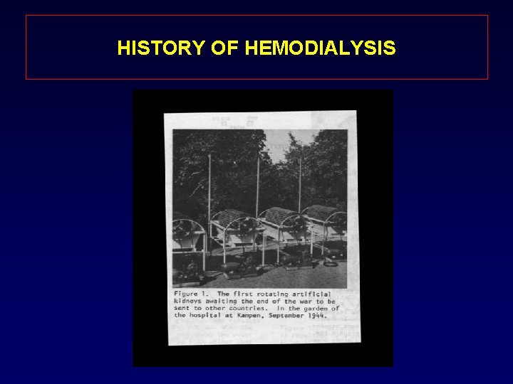 HISTORY OF HEMODIALYSIS 