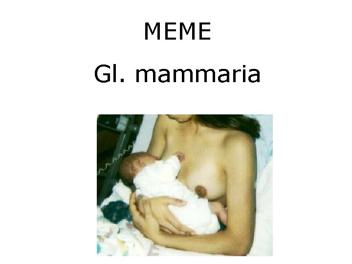 MEME Gl. mammaria 