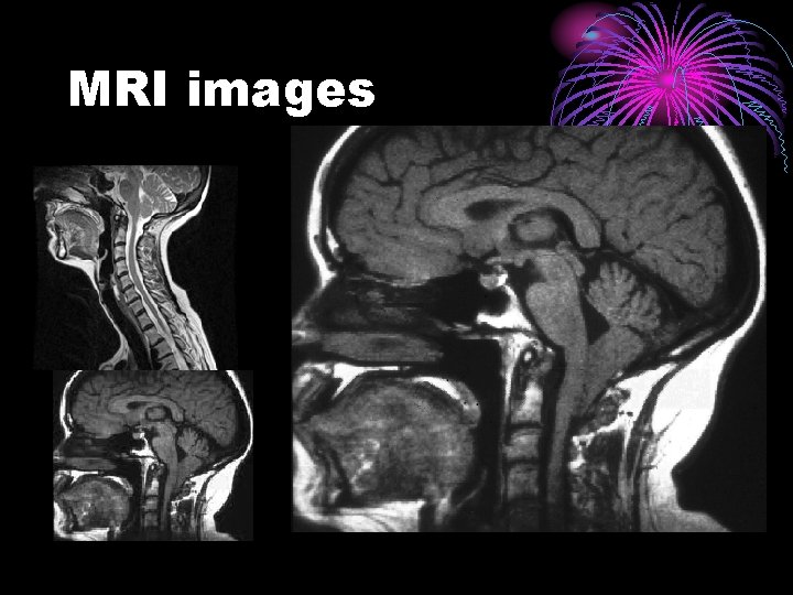 MRI images 