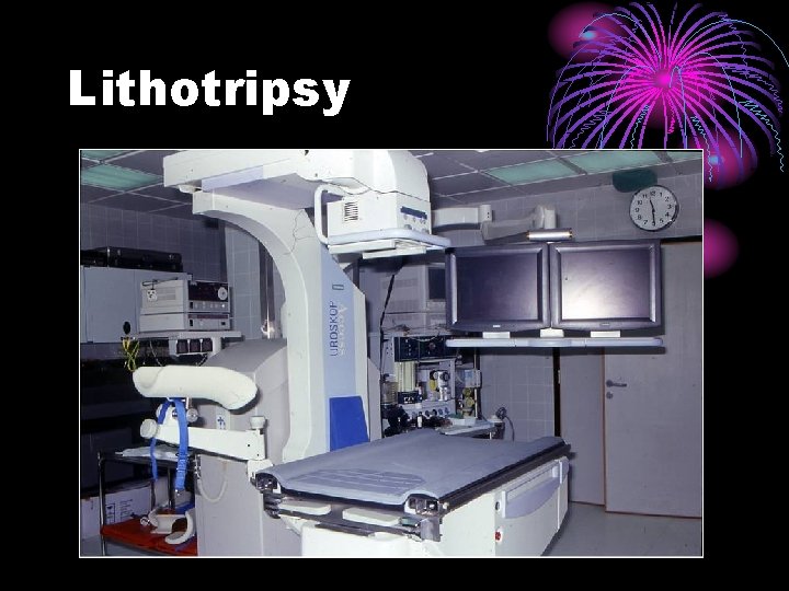 Lithotripsy 
