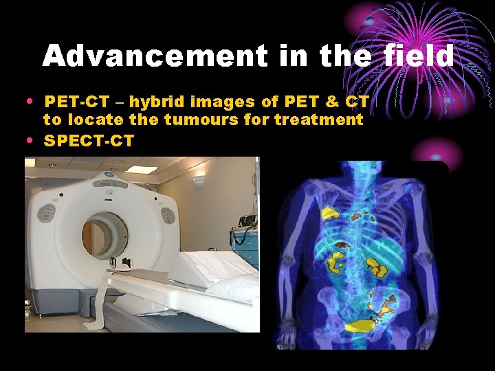 Advancement in the field • PET-CT – hybrid images of PET & CT to