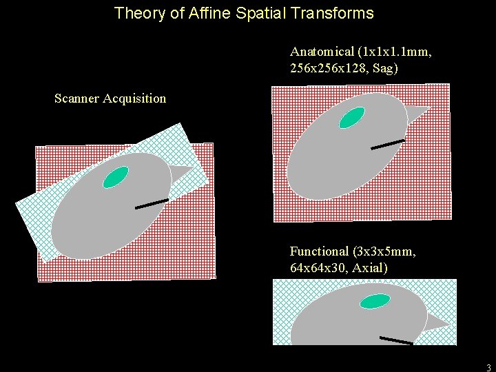 Theory of Affine Spatial Transforms Anatomical (1 x 1 x 1. 1 mm, 256