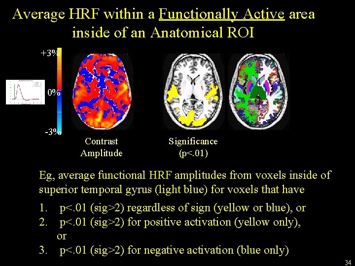 Average HRF within a Functionally Active area inside of an Anatomical ROI +3% 0%
