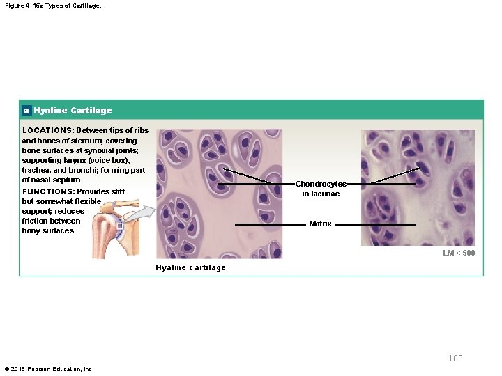 Figure 4– 15 a Types of Cartilage. a Hyaline Cartilage LOCATIONS: Between tips of