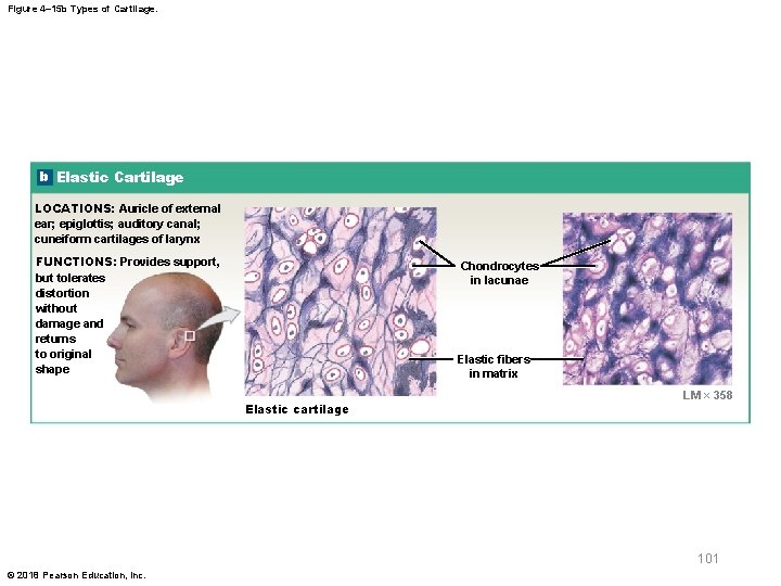 Figure 4– 15 b Types of Cartilage. b Elastic Cartilage LOCATIONS: Auricle of external