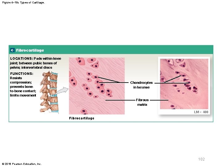 Figure 4– 15 c Types of Cartilage. c Fibrocartilage LOCATIONS: Pads within knee joint;