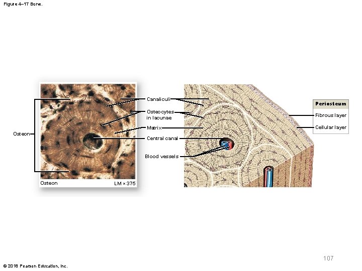 Figure 4– 17 Bone. Canaliculi Osteon Periosteum Osteocytes in lacunae Fibrous layer Matrix Cellular