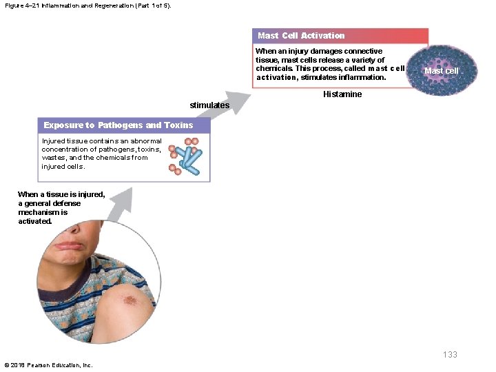 Figure 4– 21 Inflammation and Regeneration (Part 1 of 5). Mast Cell Activation When