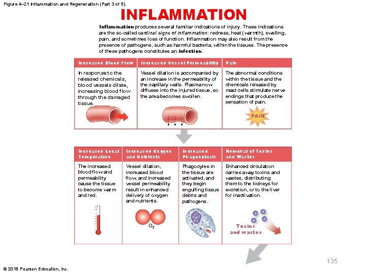 Figure 4– 21 Inflammation and Regeneration (Part 3 of 5). INFLAMMATION Inflammation produces several