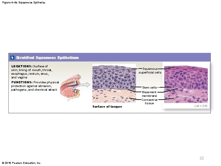 Figure 4– 4 b Squamous Epithelia. b Stratified Squamous Epithelium LOCATIONS: Surface of skin;