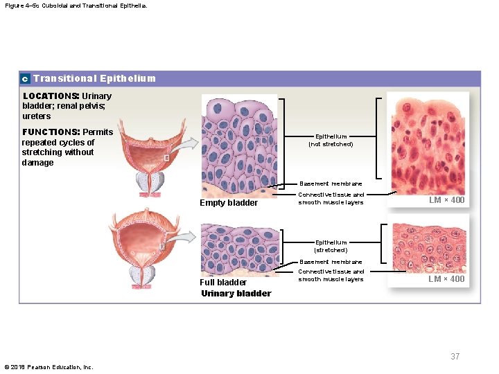 Figure 4– 5 c Cuboidal and Transitional Epithelia. c Transitional Epithelium LOCATIONS: Urinary bladder;