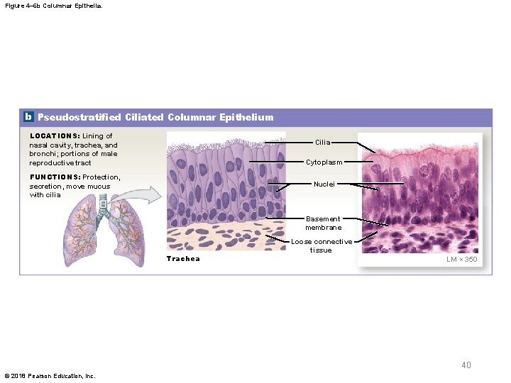 Figure 4– 6 b Columnar Epithelia. b Pseudostratified Ciliated Columnar Epithelium LOCATIONS: Lining of