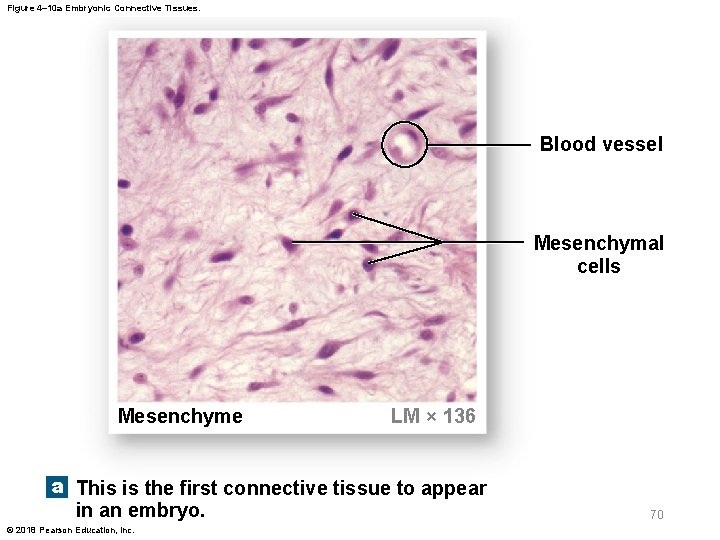 Figure 4– 10 a Embryonic Connective Tissues. Blood vessel Mesenchymal cells Mesenchyme LM ×
