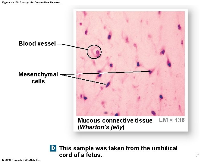 Figure 4– 10 b Embryonic Connective Tissues. Blood vessel Mesenchymal cells Mucous connective tissue