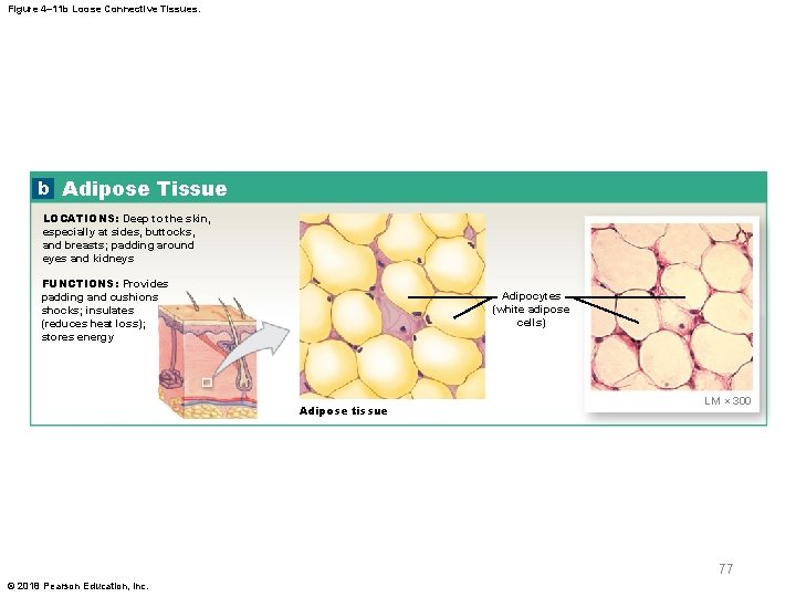 Figure 4– 11 b Loose Connective Tissues. b Adipose Tissue LOCATIONS: Deep to the