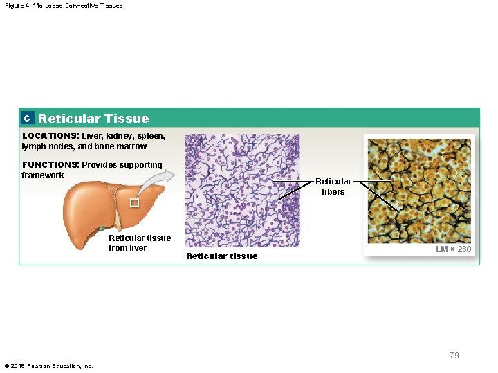 Figure 4– 11 c Loose Connective Tissues. c Reticular Tissue LOCATIONS: Liver, kidney, spleen,