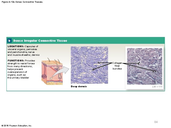 Figure 4– 12 b Dense Connective Tissues. b Dense Irregular Connective Tissue LOCATIONS: Capsules