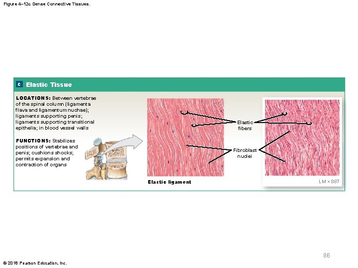 Figure 4– 12 c Dense Connective Tissues. c Elastic Tissue LOCATIONS: Between vertebrae of