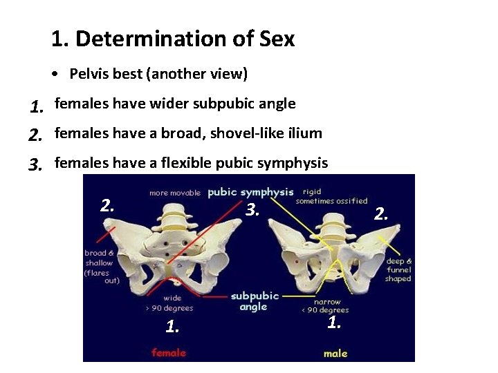 1. Determination of Sex • Pelvis best (another view) 1. females have wider subpubic