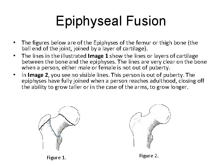 Epiphyseal Fusion • The figures below are of the Epiphyses of the femur or