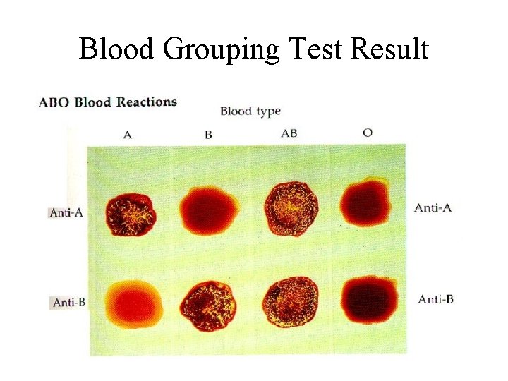 Blood Grouping Test Result 