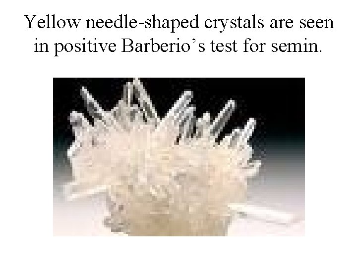 Yellow needle-shaped crystals are seen in positive Barberio’s test for semin. 