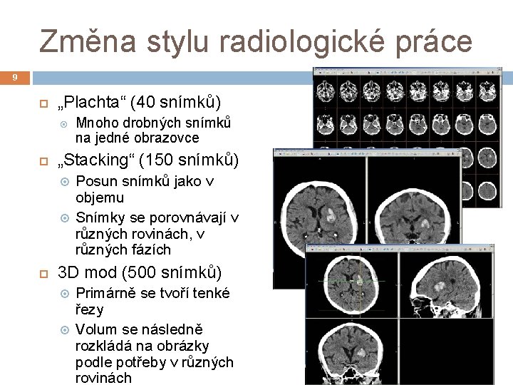 Změna stylu radiologické práce 9 „Plachta“ (40 snímků) „Stacking“ (150 snímků) Mnoho drobných snímků