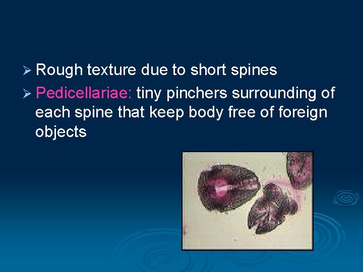 Ø Rough texture due to short spines Ø Pedicellariae: tiny pinchers surrounding of each Ø Rough texture due to short spines Ø Pedicellariae: tiny pinchers surrounding of each