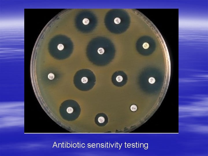 Antibiotic sensitivity testing 