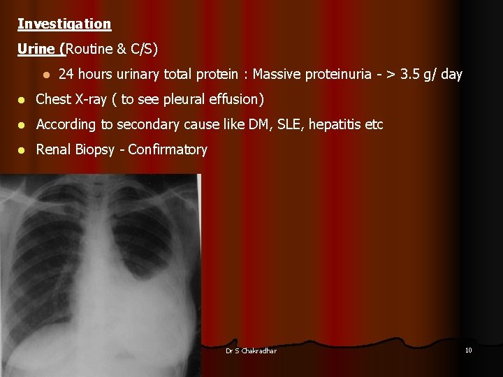 Investigation Urine (Routine & C/S) l 24 hours urinary total protein : Massive proteinuria
