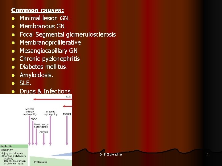 Common causes: l Minimal lesion GN. l Membranous GN. l Focal Segmental glomerulosclerosis l