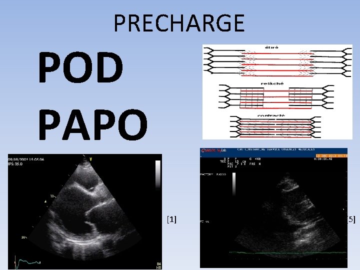 PRECHARGE POD PAPO [1] [5] 