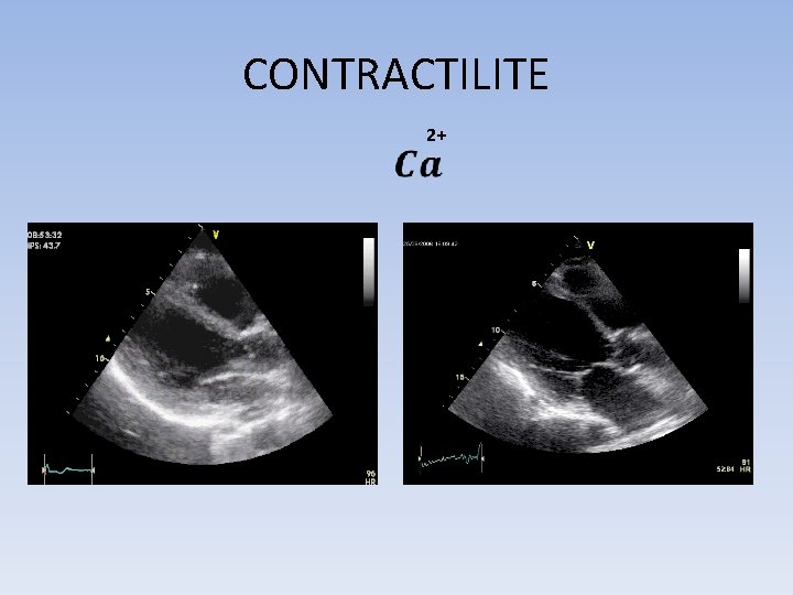 CONTRACTILITE 2+ 