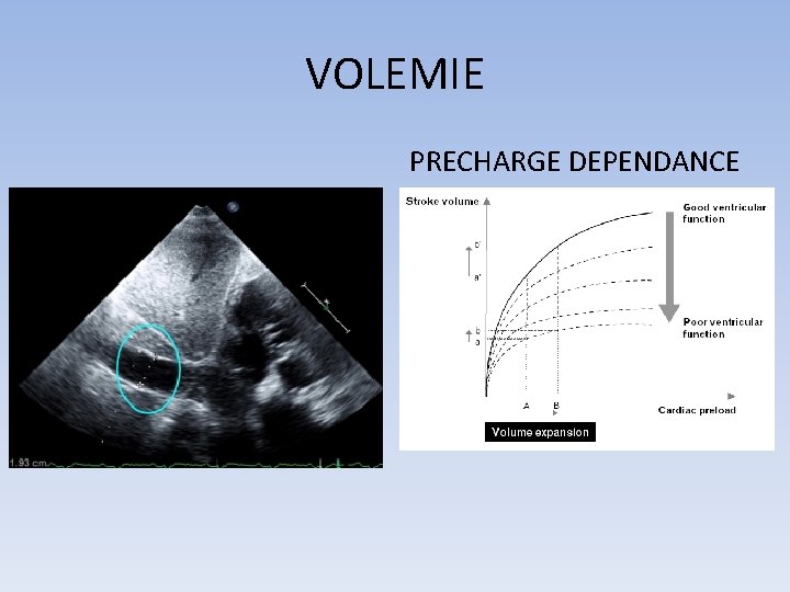 VOLEMIE PRECHARGE DEPENDANCE 