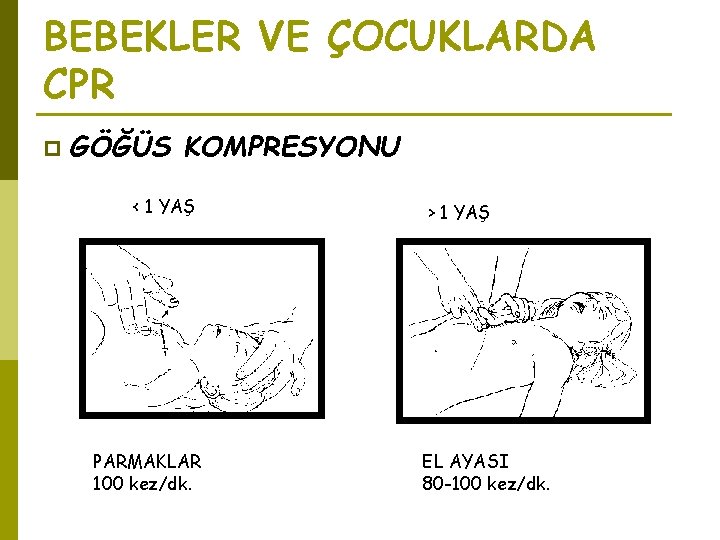 BEBEKLER VE ÇOCUKLARDA CPR p GÖĞÜS KOMPRESYONU < 1 YAŞ PARMAKLAR 100 kez/dk. >