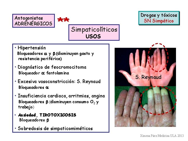 Antagonistas ADRENÉRGICOS ** Simpaticolíticos Drogas y tóxicos SN Simpático USOS • Hipertensión Bloqueadores a