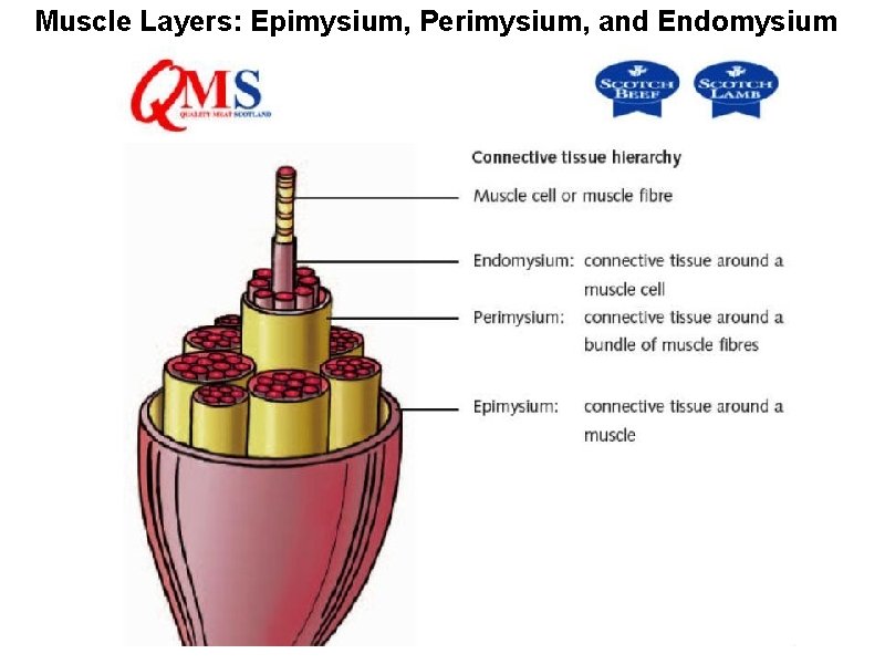 Muscle Layers: Epimysium, Perimysium, and Endomysium 