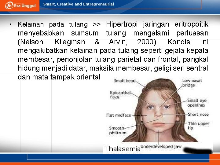  • Kelainan pada tulang >> Hipertropi jaringan eritropoitik menyebabkan sumsum tulang mengalami perluasan