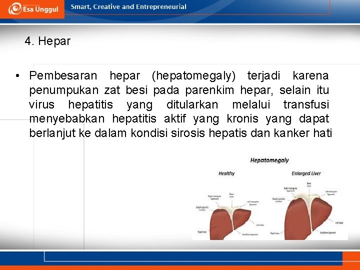 4. Hepar • Pembesaran hepar (hepatomegaly) terjadi karena penumpukan zat besi pada parenkim hepar,