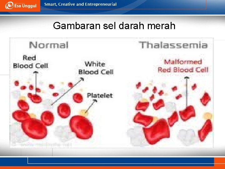 Gambaran sel darah merah 