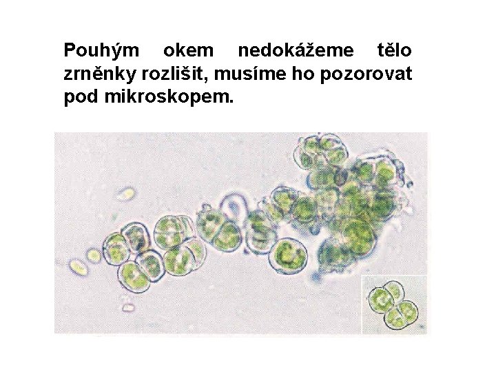 Pouhým okem nedokážeme tělo zrněnky rozlišit, musíme ho pozorovat pod mikroskopem. 