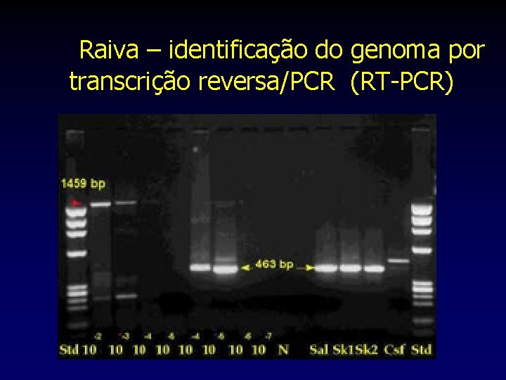 Raiva – identificação do genoma por transcrição reversa/PCR (RT-PCR) 