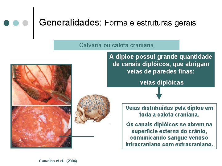 Generalidades: Forma e estruturas gerais Calvária ou calota craniana A díploe possui grande quantidade