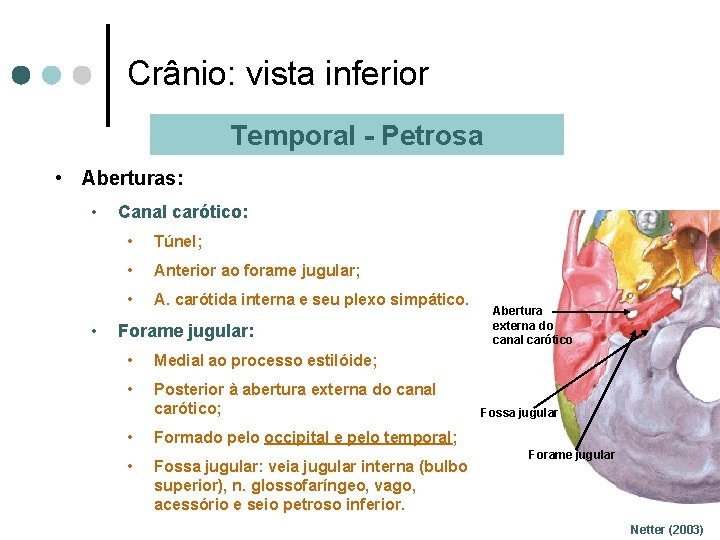 Crânio: vista inferior Temporal - Petrosa • Aberturas: • • Canal carótico: • Túnel;